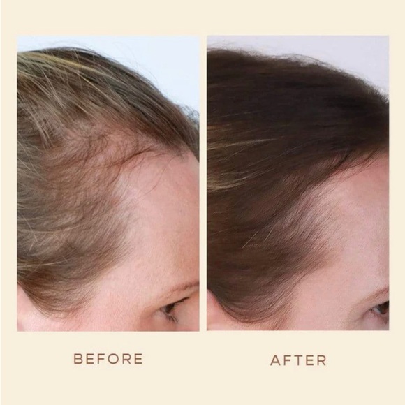 Vegamour GRO Hair Serum - Picture 5 of 9